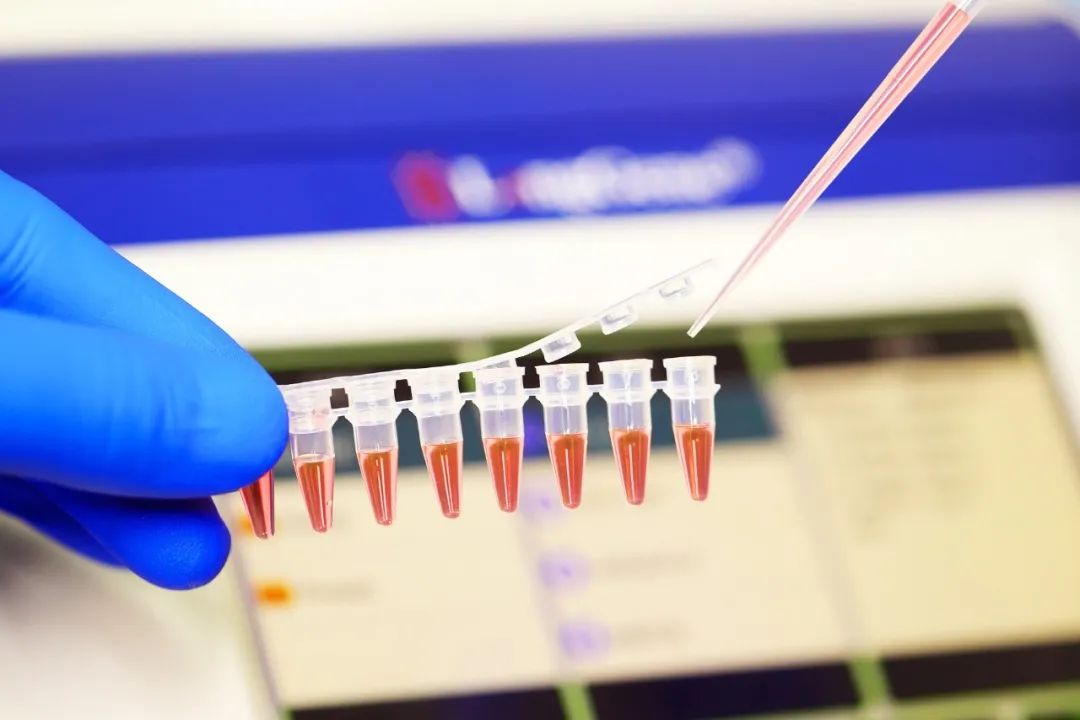 PCR/qPCR ഉപഭോഗവസ്തുക്കൾ എങ്ങനെ തിരഞ്ഞെടുക്കാം?